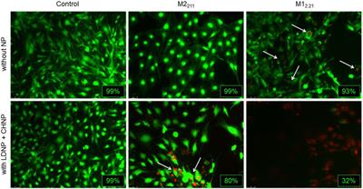 Lidocaine- and chloramphenicol-loaded nanoparticles embedded in a chitosan/hyaluronic acid/glycerol matrix: Drug-eluting biomembranes with potential for guided tissue regeneration